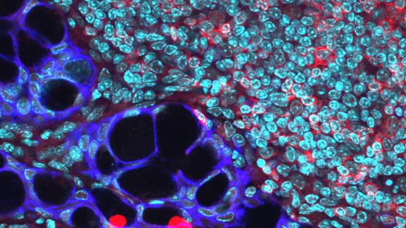 Elektronenmikroskopische Aufnahme des Mikrobioms im Darm