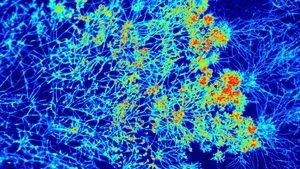 View through the microscope shows dyed protein in the fungal threads