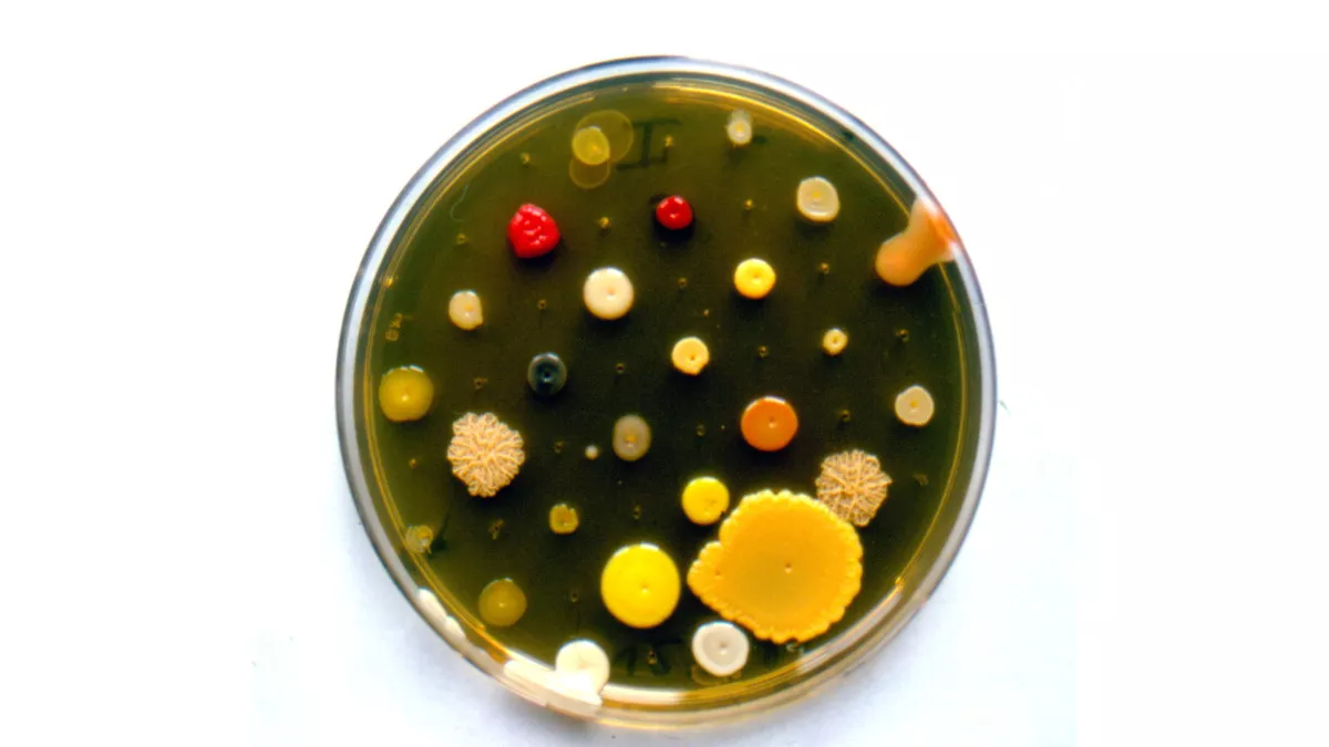 Petrischale verschiedener Bakterienkolonien