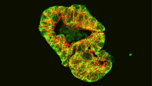 Mitochondria disruption leads to changes in the microbiome