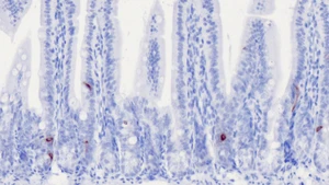 GLP-1 in a cross-section of the small intestine 