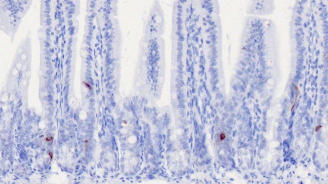 GLP-1 in a cross-section of the small intestine 