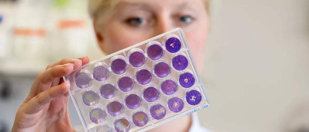 Studentin der Lebensmittelchemie mit einem Probentablett 