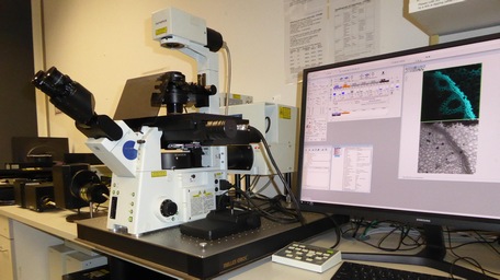 Olympus FV1000 Confocal laser scanning microscope
