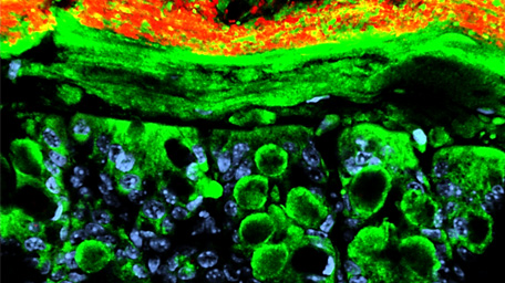MICROBIOLOGY & MICROBIOMES Microorganism of the intestinal mucosa
