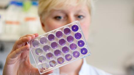 Ernährung und Lebensmittelchemie studieren an der TUM School of Life Sciences Ernährungwissenschaft und Lebensmittelchemie an der TU München studieren
